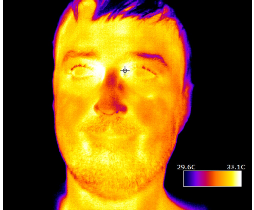Teledyne DALSA最新的热感相机为无接触发体温烧筛查提供最佳选择